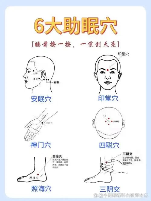 失眠安神针灸