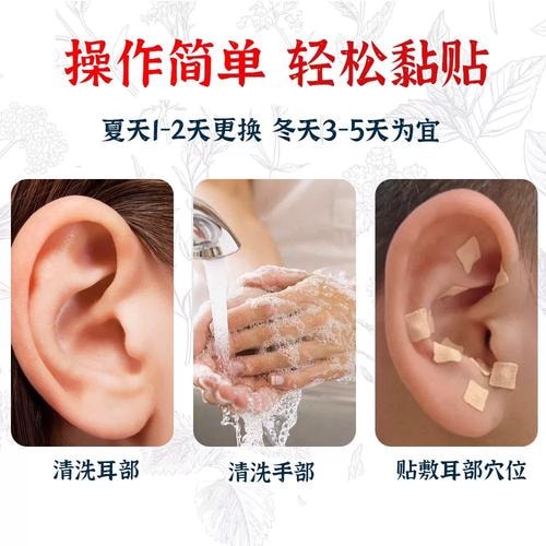 耳穴贴压理疗