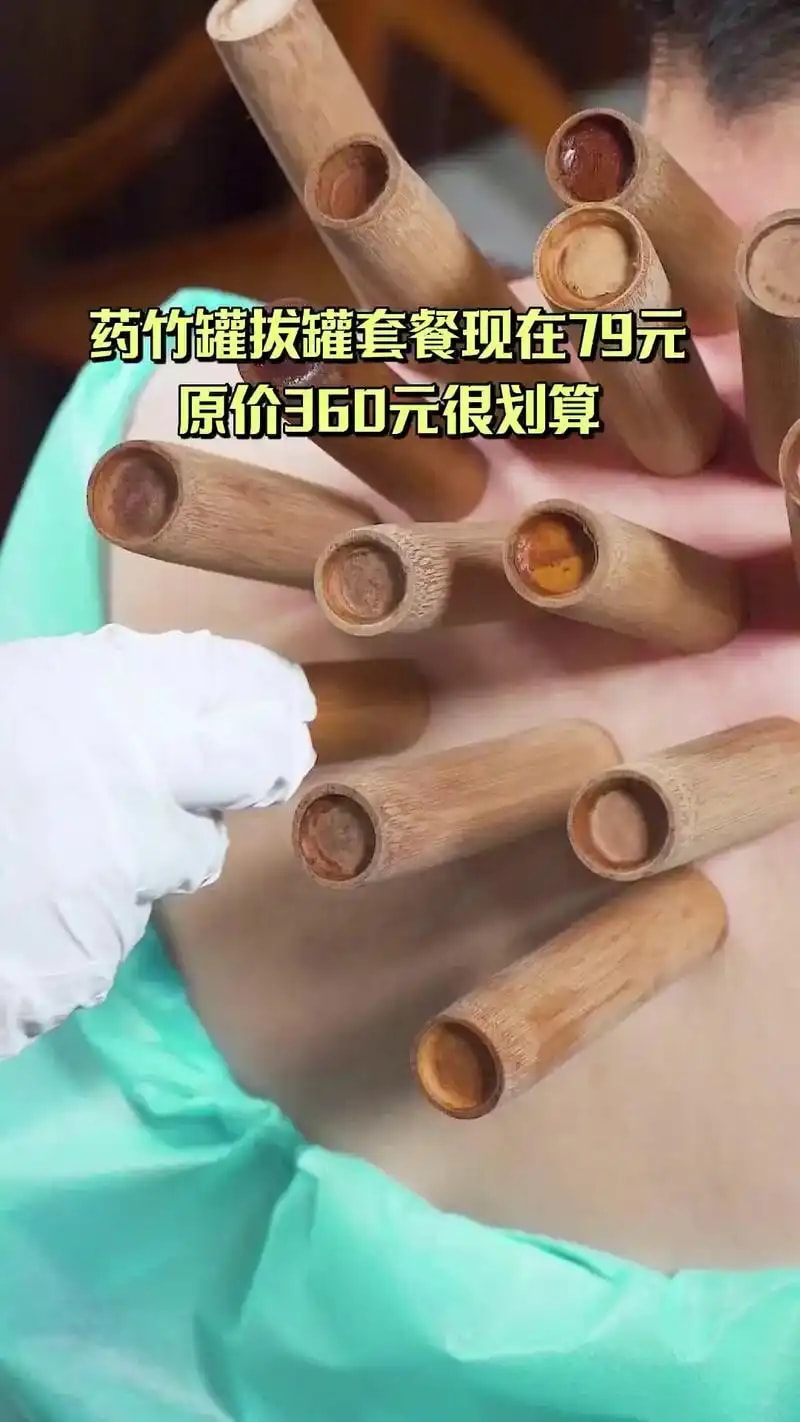 刮罐结合套餐